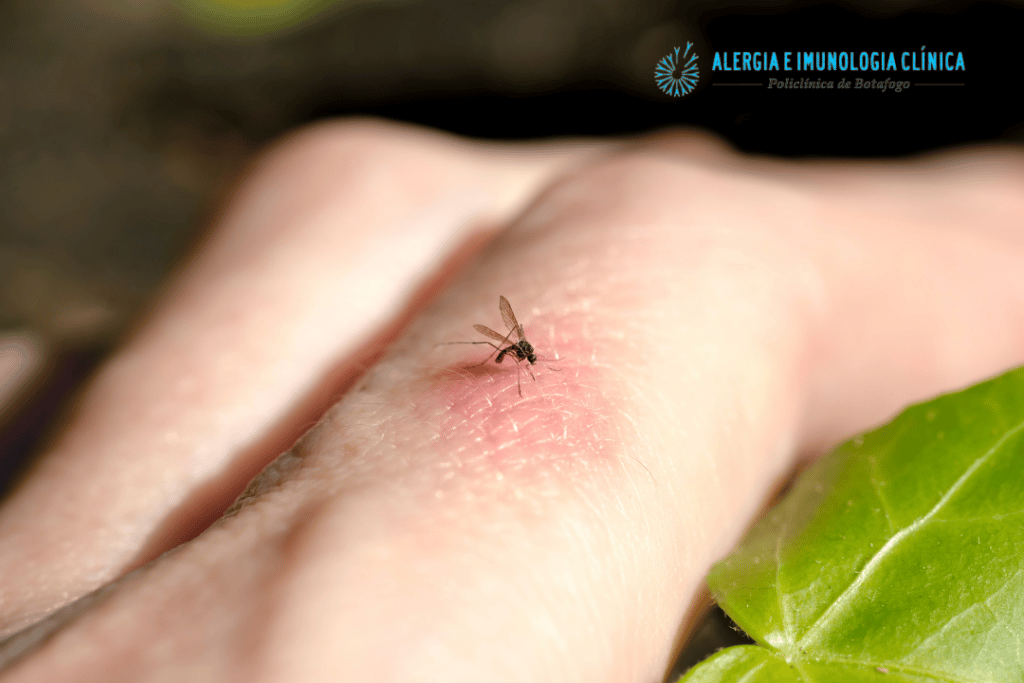 picada de mosquito infectada